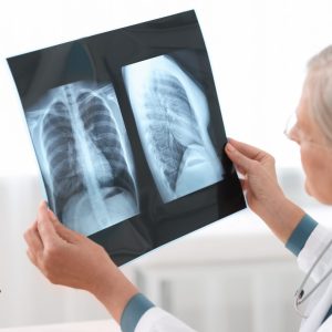 lung disease